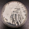 死に至る真菌感染症、NY州内で急拡大 CDC、注意を呼び掛け