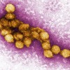 NJ州で初の死者、西ナイルウイルス　蚊を媒介に感染、今年は多く確認