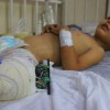 負傷し戦争孤児に……ガザ地区の子供たちの痛み