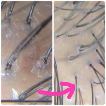 頭皮の汚れもすっきり落とし、健康な髪に